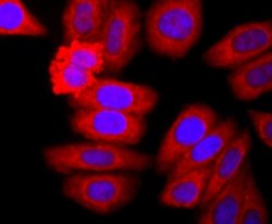 Neutrophil Elastase/ELA2 Rabbit anti-Human, Mouse, Clone: JF098-6, Novus