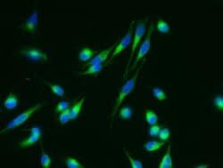 Nicastrin Rabbit anti-Human, Clone: 4, Novus Biologicals 50 &mu;g; Unconjugated:Antibodies,
