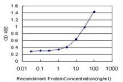 Nicotinamide N-Methyltransferase/NNMT Antibody (2F2), Novus Biologicals 0.1 mg | Buy Online | Novus Biologicals | Fisher Scientific