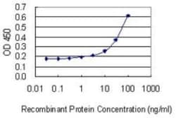 Nicotinic Acetylcholine R alpha 1/CHRNA1 Antibody (2G5), Novus Biologicals 0.1 mg | Buy Online | Novus Biologicals | Fisher Scientific