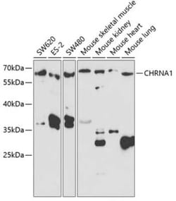 Nicotinic Acetylcholine R alpha 1/CHRNA1 Antibody - BSA Free, Novus Biologicals