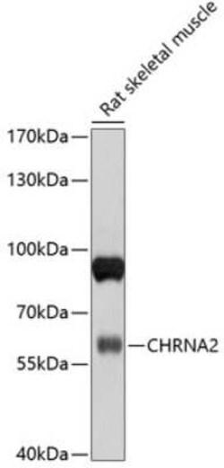 Nicotinic Acetylcholine R alpha 2/CHRNA2 Antibody - BSA Free, Novus Biologicals