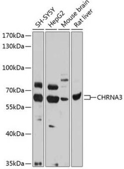 Nicotinic Acetylcholine R alpha 3/CHRNA3 Antibody - BSA Free, Novus Biologicals