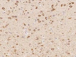 Nicotinic Acetylcholine R alpha 7/CHRNA7 Antibody, Novus Biologicals 50