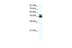 Nicotinic Acetylcholine Receptor beta 2 Rabbit anti-Human, Mouse, Polyclonal,