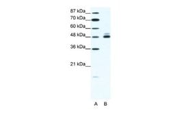 Nicotinic Acetylcholine Receptor beta 2 Rabbit anti-Human, Mouse, Polyclonal,