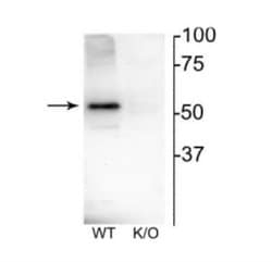 Nicotinic Acetylcholine Receptor beta 4 Antibody, Novus Biologicals 100&mu;L:Antibodies,