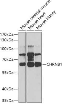 Nicotinic Acetylcholine Receptor beta Antibody - BSA Free, Novus Biologicals