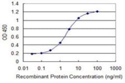 Nicotinic Acetylcholine Receptor epsilon Antibody (6A2), Novus Biologicals 0.1 mg | Buy Online | Novus Biologicals | Fisher Scientific