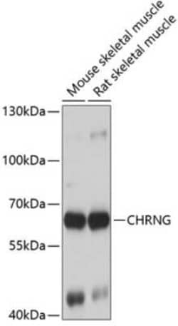 Nicotinic Acetylcholine Receptor gamma Antibody - BSA Free, Novus Biologicals