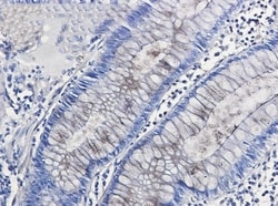 Nidogen-1/Entactin Antibody (S08-3H3), Novus Biologicals 100 &mu;g; Unconjugated:Antibodies,