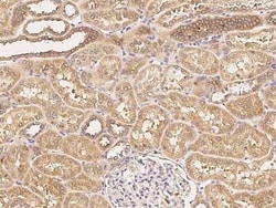 Niemann-Pick C1 Antibody, Novus Biologicals 50 &mu;g, Unconjugated:Antibodies,