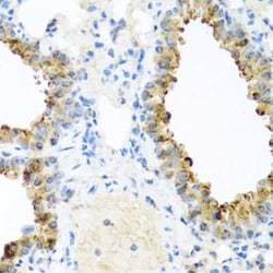 Ninein Antibody - BSA Free, Novus Biologicals:Antibodies:Primary Antibodies