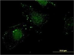 Nitrilase 1 Antibody (1C3), Novus Biologicals 0.1 mg, Unconjugated:Antibodies,