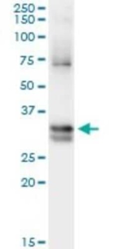 Nitrilase 1 Antibody (1C3), Novus Biologicals 0.1 mg, Unconjugated:Antibodies,