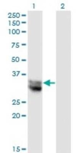 Nitrilase 1 Antibody (1C3), Novus Biologicals 0.1 mg, Unconjugated:Antibodies,