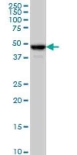 Njmu-R1 Antibody (2D7), Novus Biologicals 0.1 mg | Buy Online | Novus Biologicals | Fisher Scientific