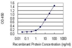 Nocturnin Antibody (3E8), Novus Biologicals 0.1 mg | Buy Online | Novus Biologicals | Fisher Scientific