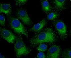 Nogo Rabbit anti-Human, Mouse, Clone: JM02-34, Novus Biologicals 100 &mu;l;
