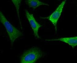 Nogo Rabbit anti-Human, Mouse, Clone: JM02-34, Novus Biologicals 100 &mu;l;