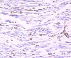 Nogo Rabbit anti-Human, Mouse, Clone: JM02-34, Novus Biologicals 100 &mu;l;