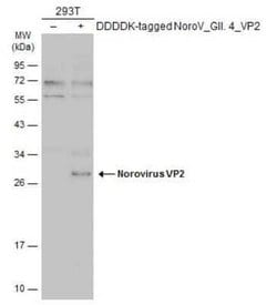 Norovirus VP2 Antibody, Novus Biologicals 100 &mu;g | Buy Online | Novus Biologicals | Fisher Scientific