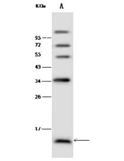 Norrin/NDP Antibody, Novus Biologicals 100 &mu;g; Unconjugated:Antibodies,