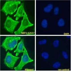 Notch-1 Antibody (E6) - Chimeric - Azide and BSA Free, Novus Biologicals