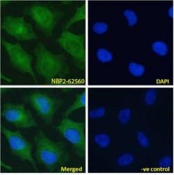 Notch-2 Antibody (B9) - Chimeric - Azide and BSA Free, Novus Biologicals 0.2 mg | Buy Online | Novus Biologicals | Fisher Scientific