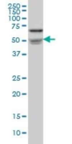Nova1 Antibody (3F3), Novus Biologicals 0.1 mg | Buy Online | Novus Biologicals | Fisher Scientific