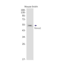 Nova1 Antibody (S06-8K6), Novus Biologicals 100 &mu;g; Unconjugated:Antibodies,