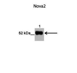 Nova2 Rabbit anti-Human, Polyclonal, Novus Biologicals 0.1 mL; Unconjugated:Antibodies,