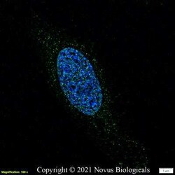 Noxa Antibody (114C307.1R) - BSA Free, Novus Biologicals 0.025 mg; Unconjugated:Antibodies,
