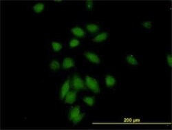 NuMA Antibody (1C5), Novus Biologicals 0.1 mg | Buy Online | Novus Biologicals | Fisher Scientific