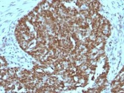 Nucleolin Antibody (364-5 + NCL/902), Novus Biologicals 0.02mg; Unlabeled:Antibodies,