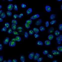 Nucleolin Antibody (364-5), Novus Biologicals:Antibodies:Primary Antibodies