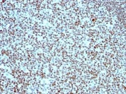 Nucleolin Antibody (364-5), Novus Biologicals:Antibodies:Primary Antibodies