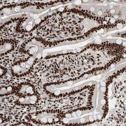 Nucleolin Antibody, Novus Biologicals 0.1 mL; Unconjugated:Antibodies,