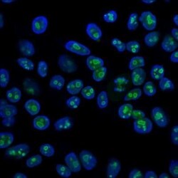 Nucleolin Antibody (SPM614), Novus Biologicals:Antibodies:Primary Antibodies