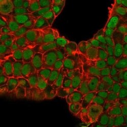Nucleolin Antibody (SPM614), Novus Biologicals:Antibodies:Primary Antibodies