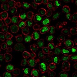 Nucleolin Antibody (SPM614), Novus Biologicals:Antibodies:Primary Antibodies