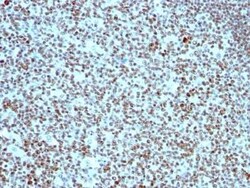 Nucleolin Antibody (SPM614), Novus Biologicals:Antibodies:Primary Antibodies