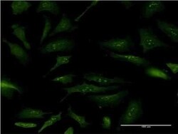 Nucleoplasmin-2 Antibody (5E9), Novus Biologicals 0.1 mg | Buy Online | Novus Biologicals | Fisher Scientific