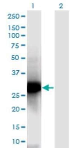 Nucleoplasmin-2 Antibody (5E9), Novus Biologicals 0.1 mg | Buy Online | Novus Biologicals | Fisher Scientific