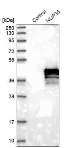 Nup53 Antibody, Novus Biologicals 0.1 mL, Unconjugated:Antibodies, Polyclonal