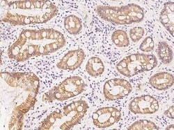 Nurim Antibody, Novus Biologicals 50 &mu;g; Unconjugated:Antibodies, Polyclonal