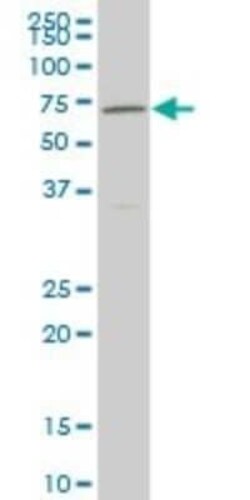 Nurr1/NGFI-B beta/NR4A2 Antibody (1C6), Novus Biologicals 0.1 mg, Unconjugated:Antibodies,