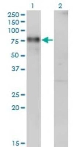 Nurr1/NGFI-B beta/NR4A2 Antibody (1C6), Novus Biologicals 0.1 mg, Unconjugated:Antibodies,
