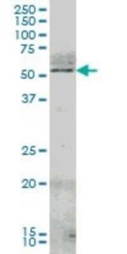 Nurr1/NGFI-B beta/NR4A2 Antibody (1G6), Novus Biologicals 100 &mu;g | Buy Online | Novus Biologicals | Fisher Scientific