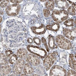 O-GlcNAc Transferase p110 subunit Antibody, Novus Biologicals 0.1 mL, Unconjugated:Anticorps,